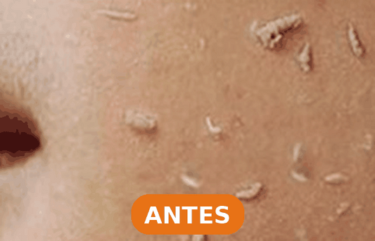 Gel Exfoliante de Naranja - Piel Suave y Luminosa